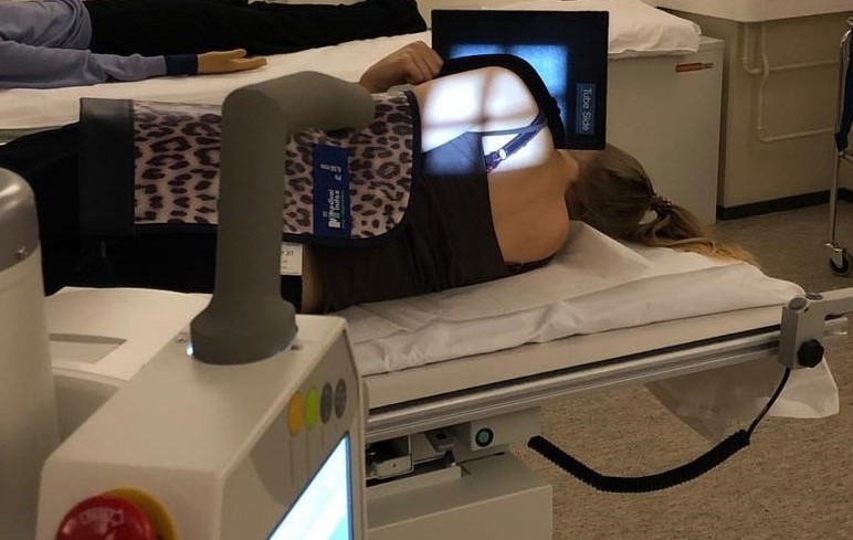 Olkapään röntgentutkimus